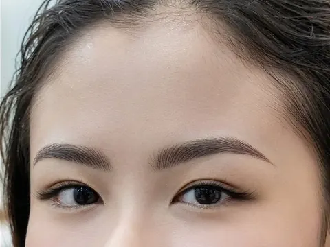Bước 4: Phục hồi da