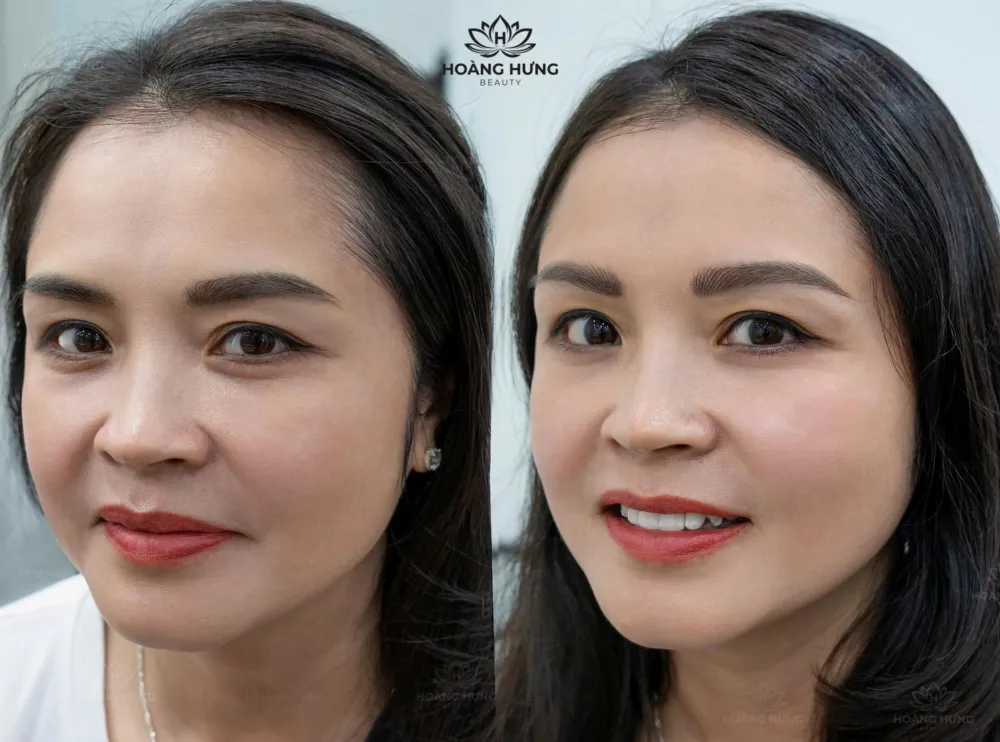 Khách hàng trước và sau khi sửa mày đậm tại Hoàng Hưng Beauty