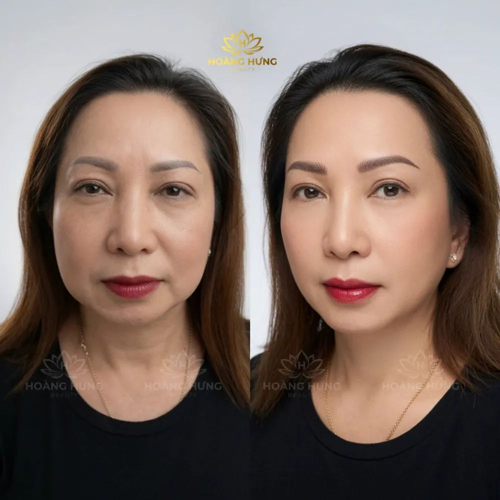 Khách hàng trước và sau khi sửa dáng mày tại Hoàng Hưng Beauty