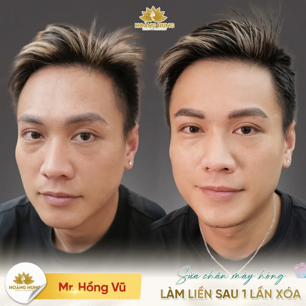 Mr. Hồng Vũ sửa chân mày hỏng, làm lại ngay sau 1 lần xoá